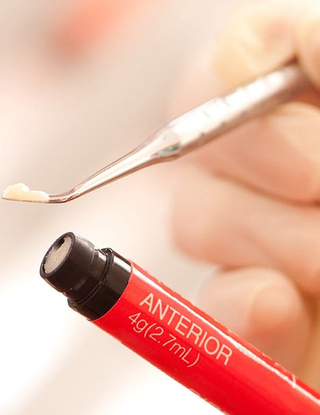 Dentist in Mission Viejo holding composite resin